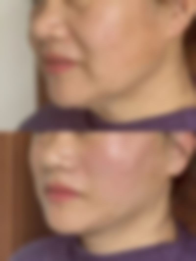深圳恒生医院整形美容科地址电话、营业时间
