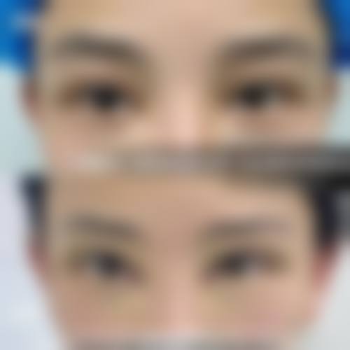 韩国VIP整形外科收费价格表