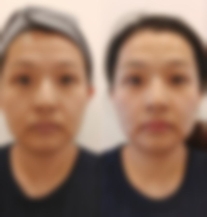 湘潭仁和整形美容医院收费价格表
