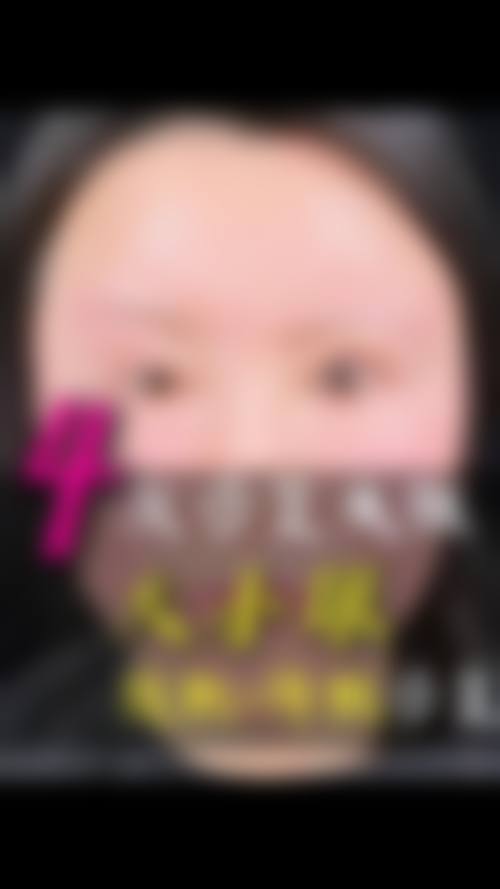 方涛医生项目收费价格