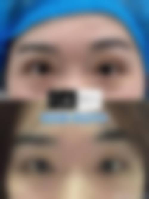 方涛医生技术优势