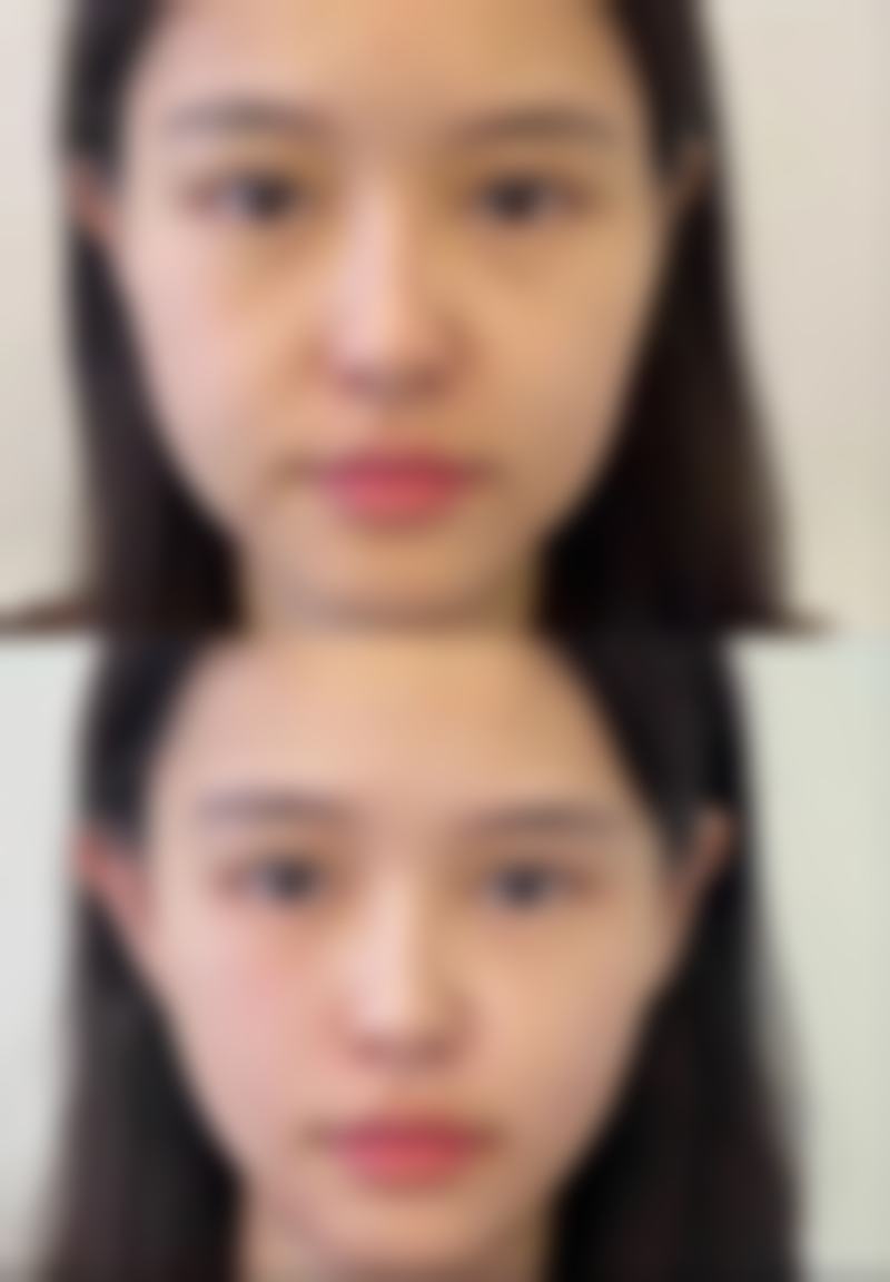 长沙暄美齿科(坪塘分院）收费价格表