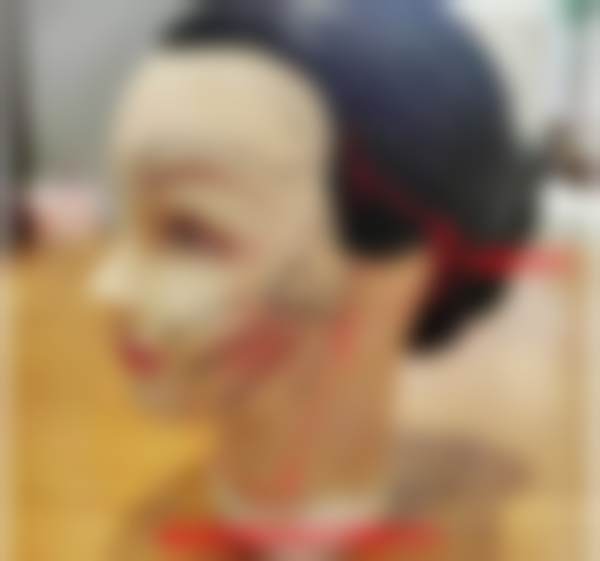 孙瑛医生技术优势