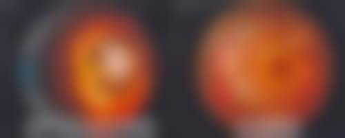 桂林爱尔眼科医院怎么预约挂号？
