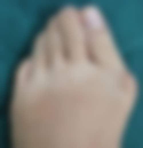 赵珮娟医生预约挂号