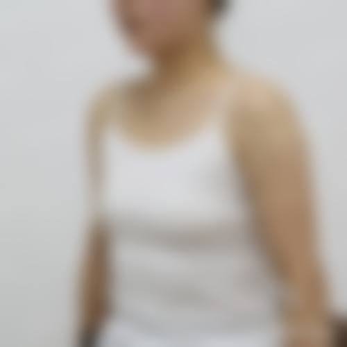 克拉玛依艺启美整形医院收费价格表