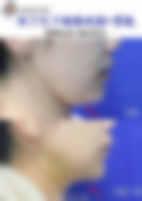 朴良洙医生技术优势
