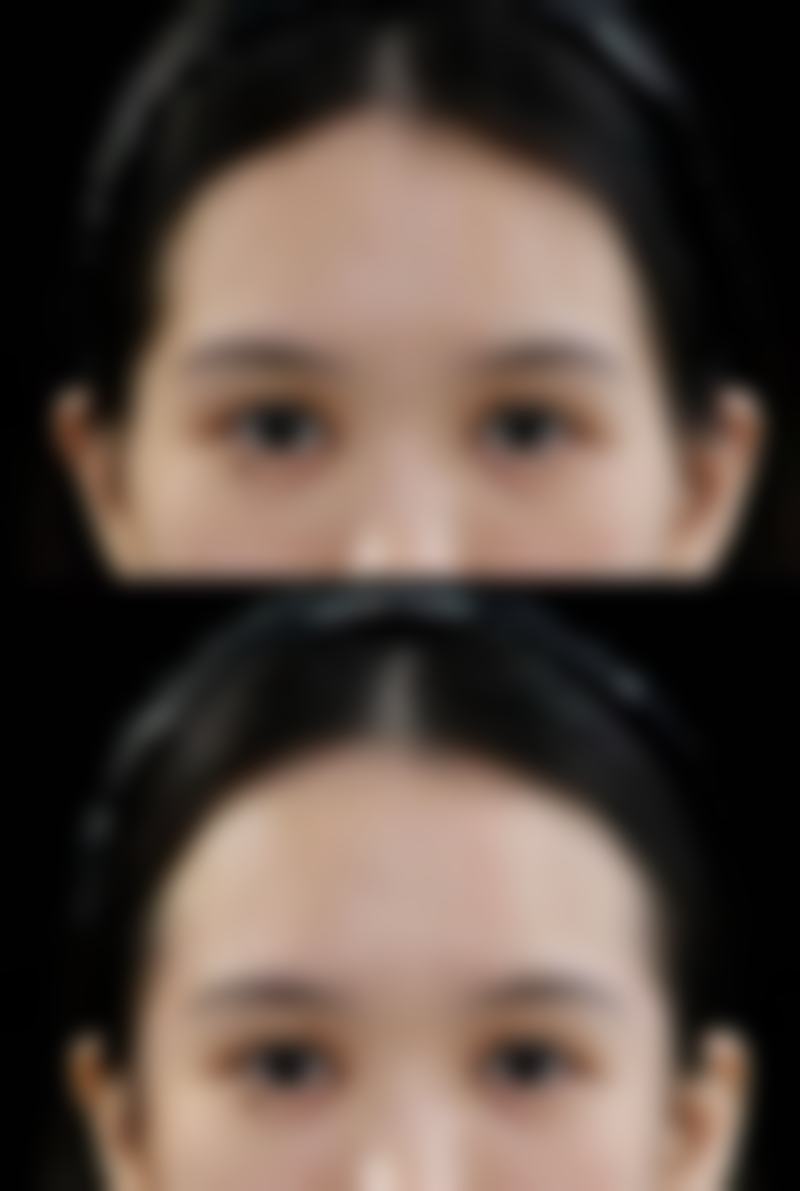 杨松林医生技术优势