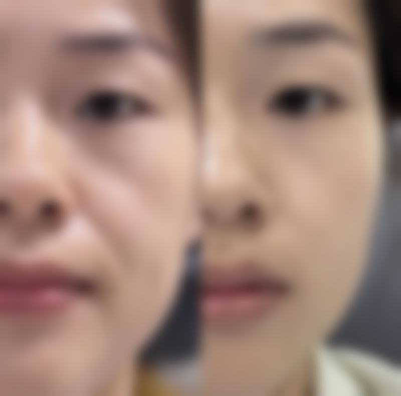 杨松林医生项目收费价格
