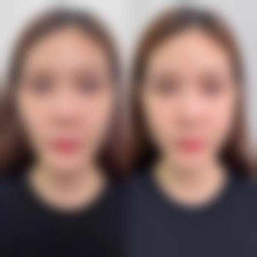 南通南洋整形医院收费价格表