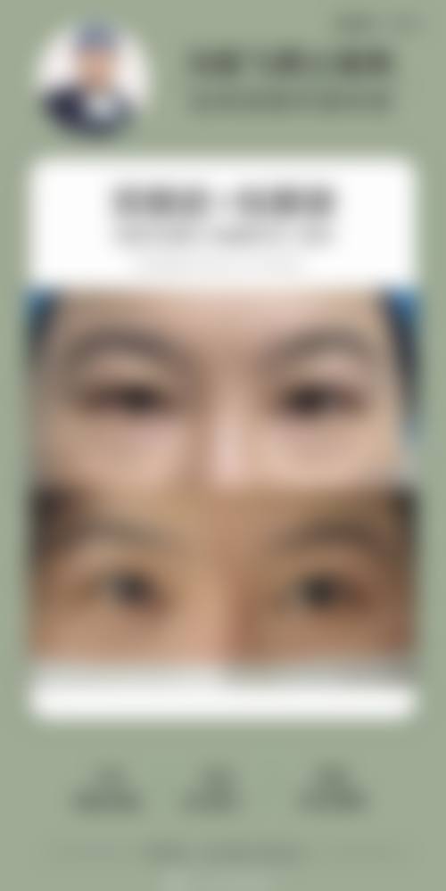 佛山苏李秀英医院激光整形美容医院特色诊疗项目与技术优势