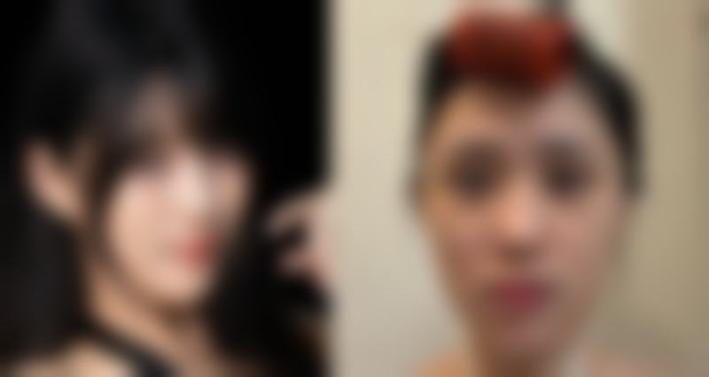 舟山市艾美医学美容收费价格表