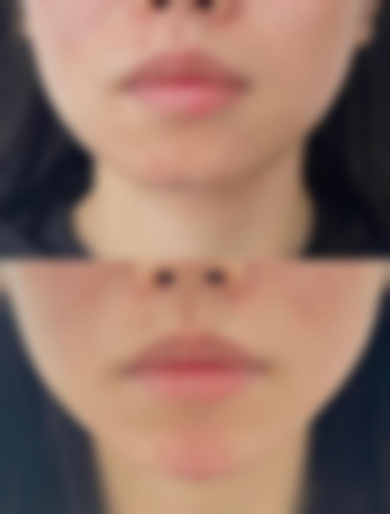 陈淑端医生技术优势