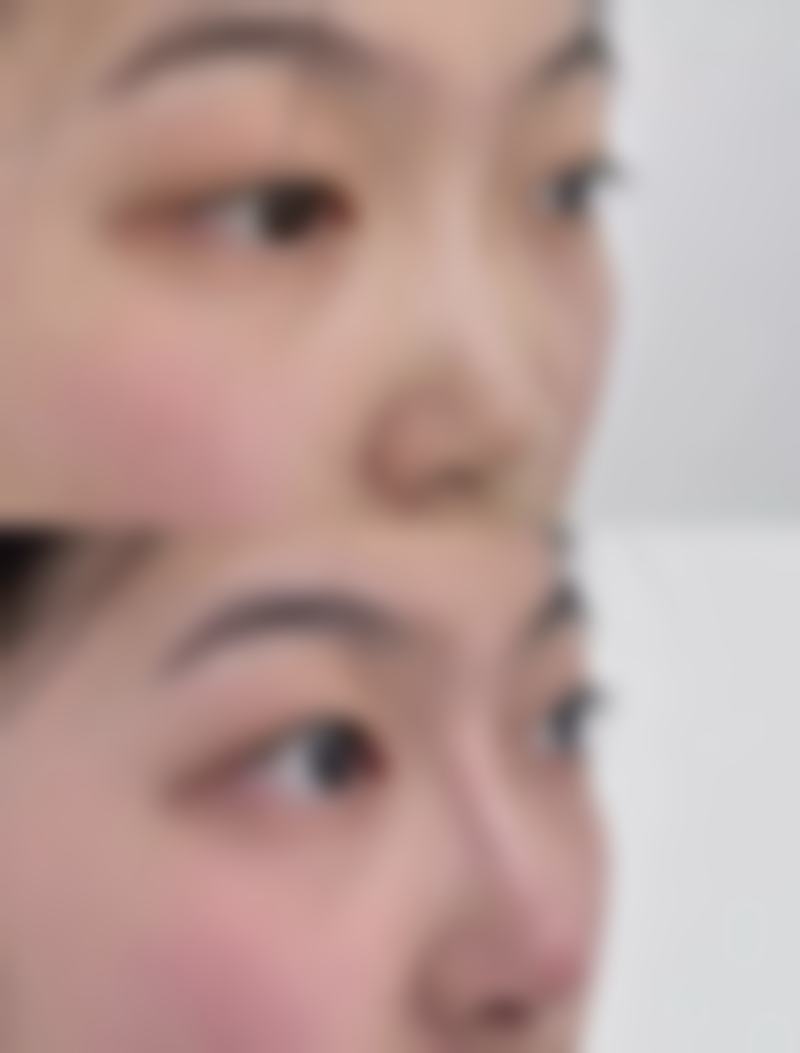 佛山苏李秀英医院激光整形美容医院地址电话、营业时间