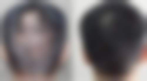 梁仲斌医生预约挂号