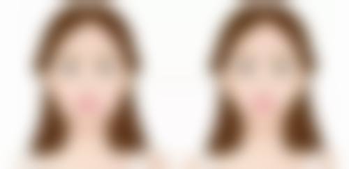 张特医生预约挂号
