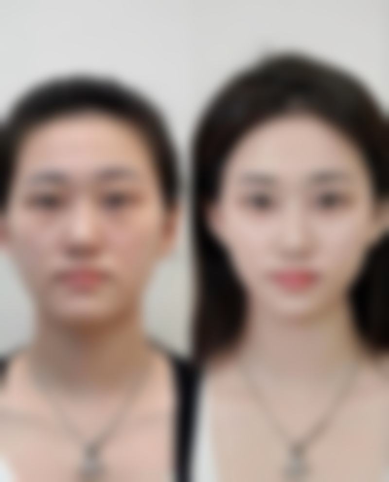 包头汝嫣整形医院收费价格表