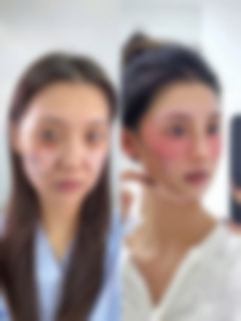 张兰医生项目收费价格