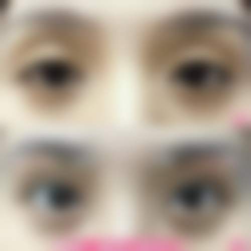 郑州华山医疗美容医院三、郑州华 山医疗美容医院怎么样，口碑评价如何？