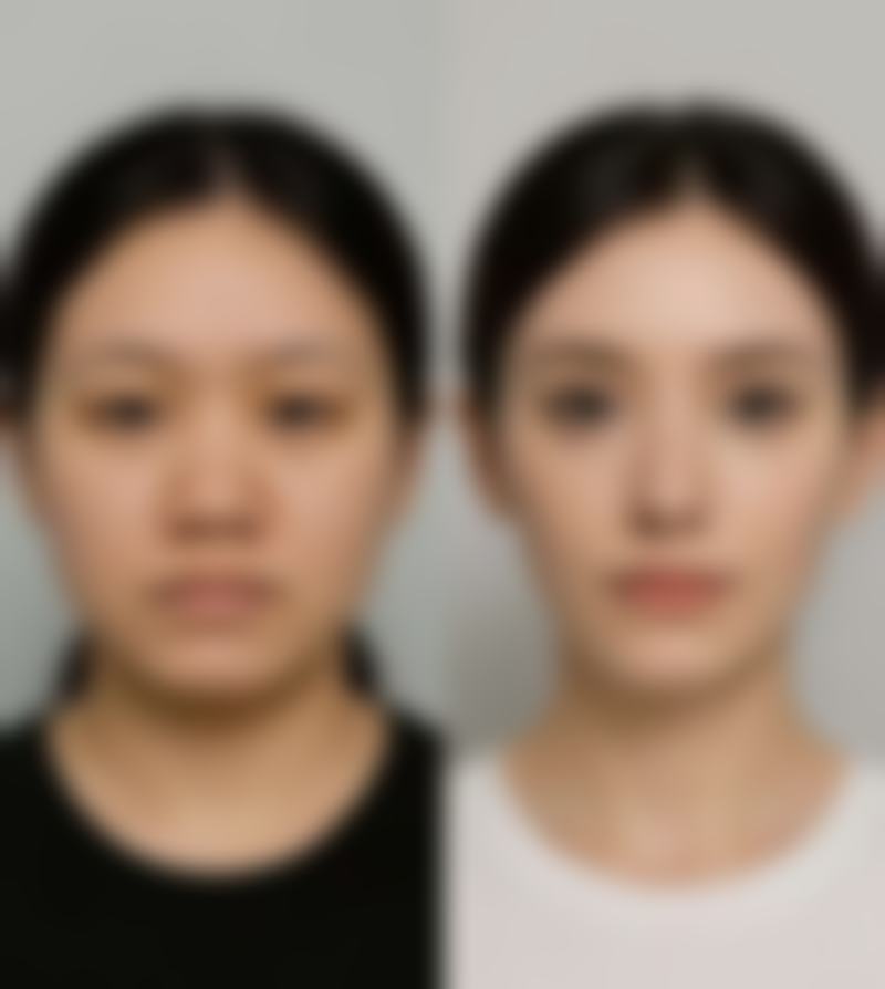 李柄旭医生预约挂号
