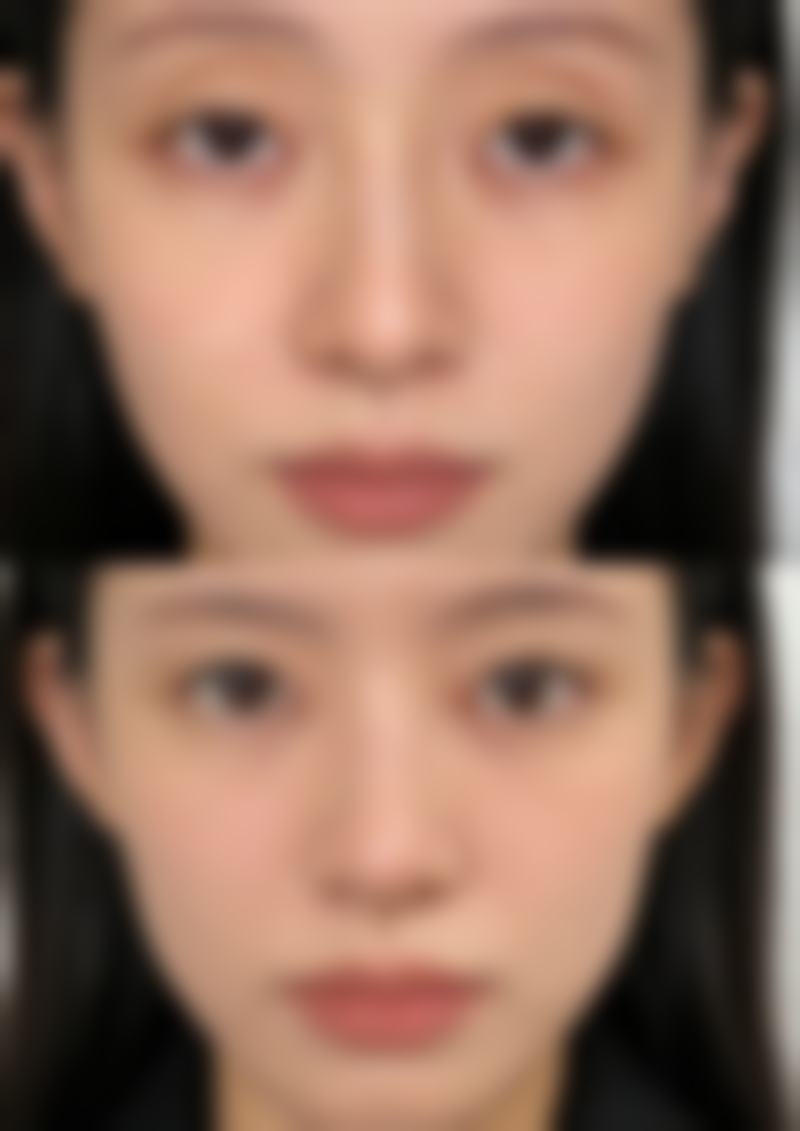 韩国BR整形外科医院医疗环境与配套设施