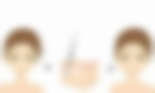牙生·买买提医生技术优势