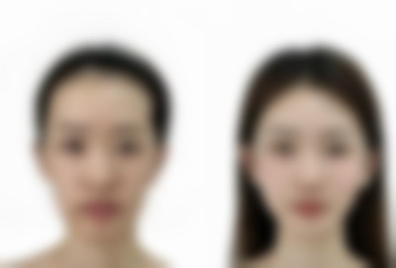 闫柳医生预约挂号