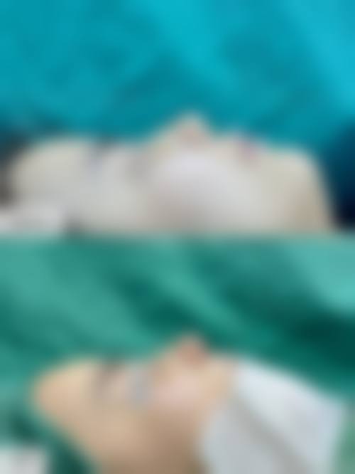 张志亮医生技术优势