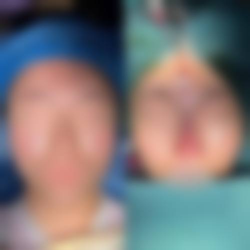 张志亮医生项目收费价格