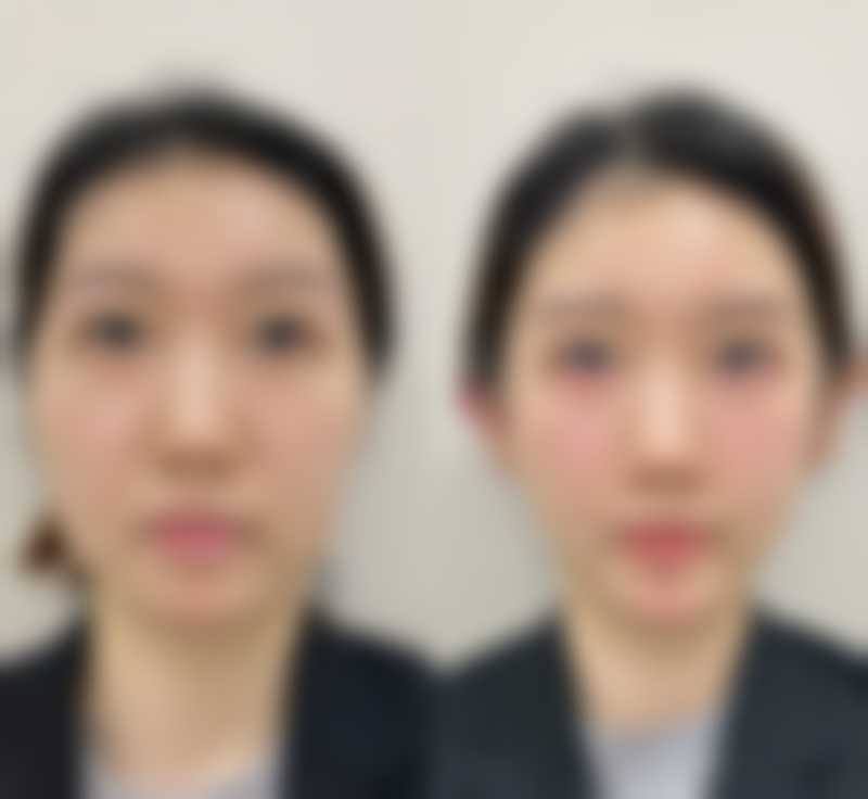 黄莉雯医生预约挂号