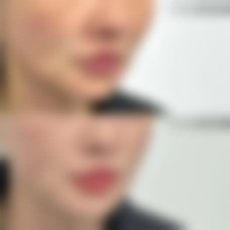韩国iFace整形外科预约挂号方式