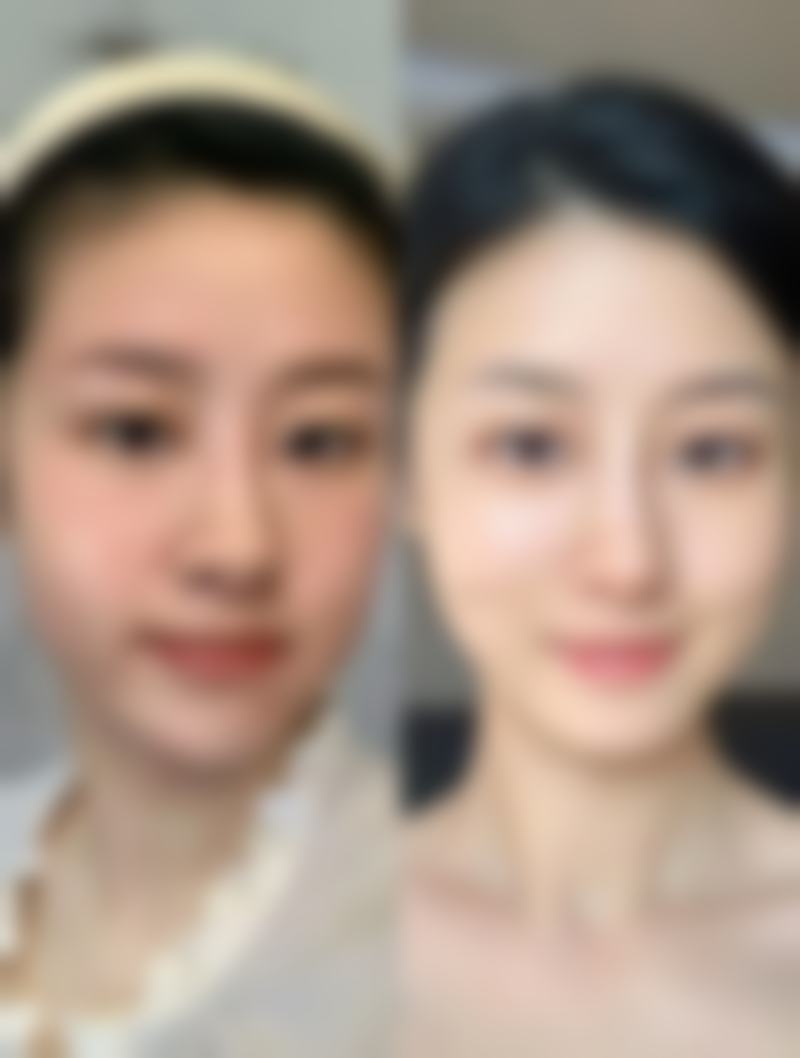西峰区医师乔红英医疗美容诊所收费价格表
