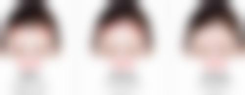 曾祥康医生项目收费价格