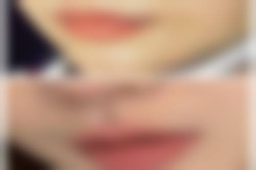 杨基勋医生项目收费价格