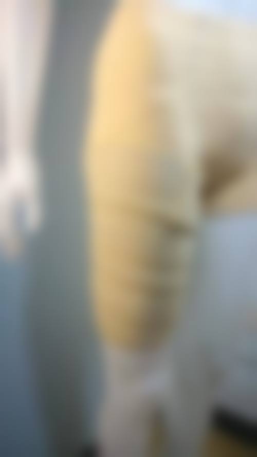 王晓英医生项目收费价格