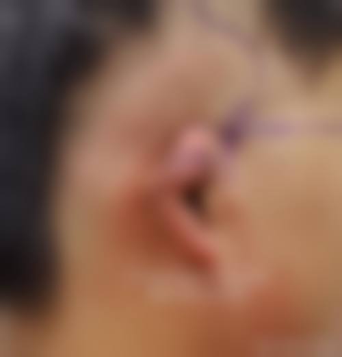 雷秋梅医生预约挂号