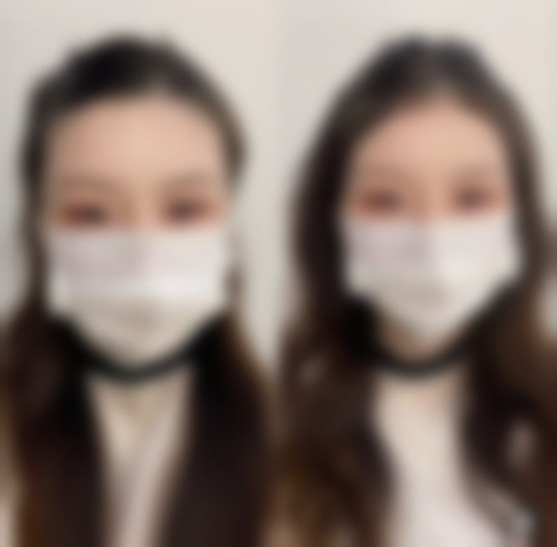 吴政君医生技术优势