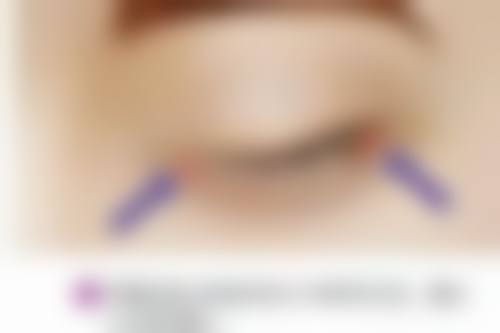 邯郸第五医院整形科预约挂号方式