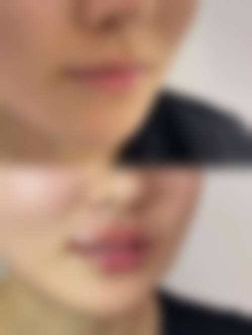 林亚红医生技术优势