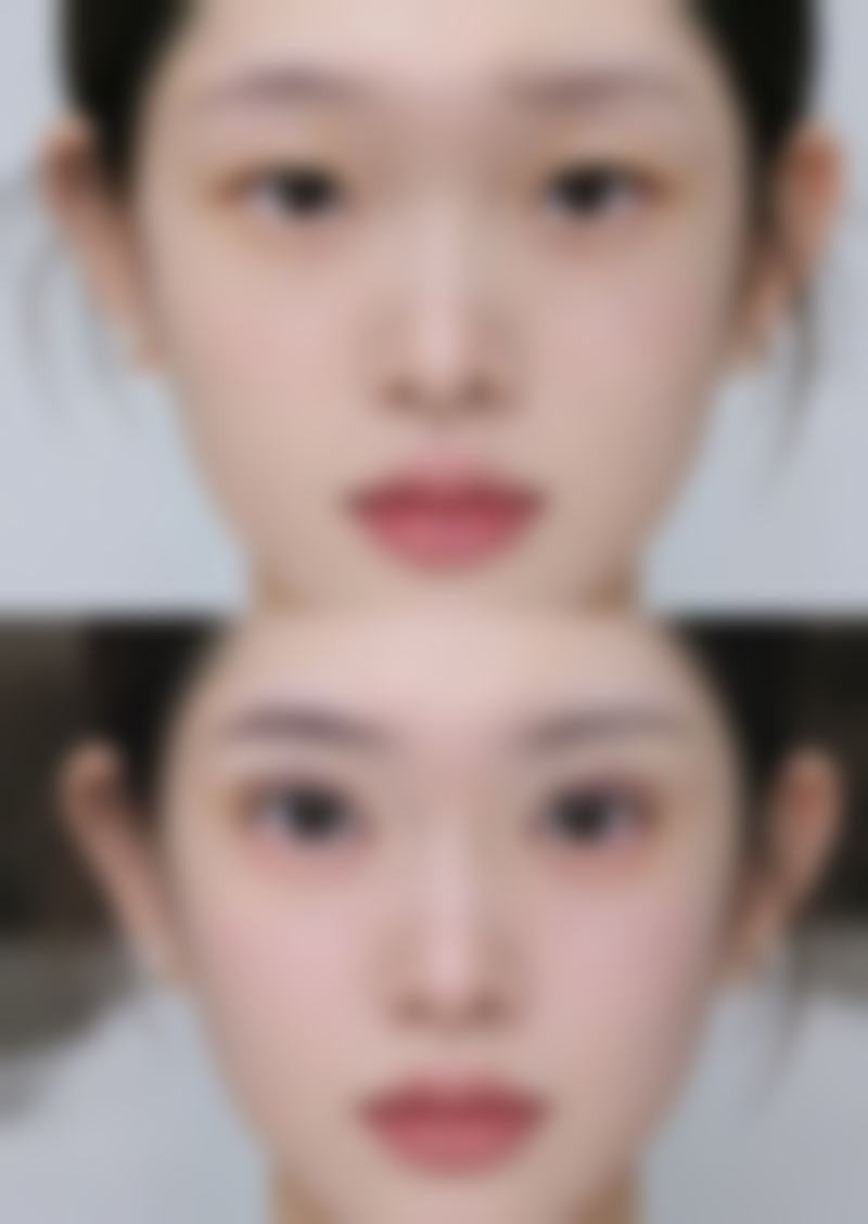 李燕医生项目收费价格