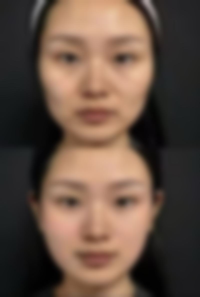 吕明医生项目收费价格