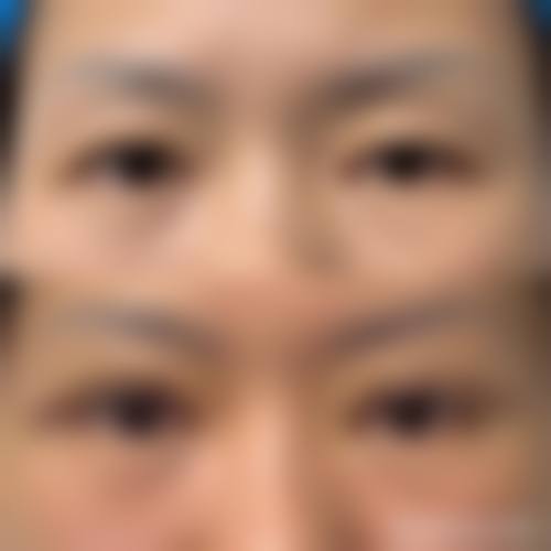 苏禧医生技术优势