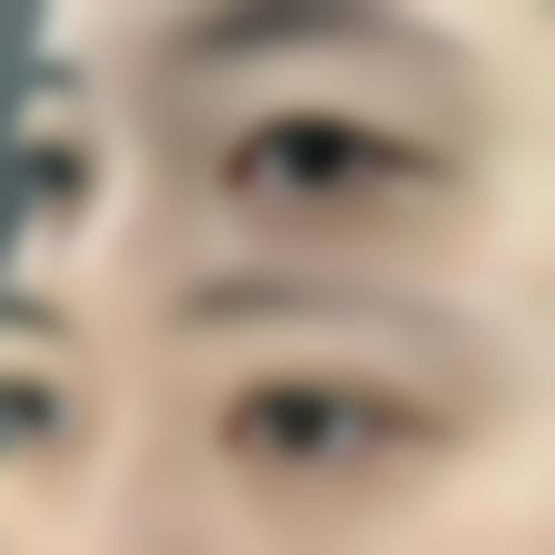 苏禧医生项目收费价格