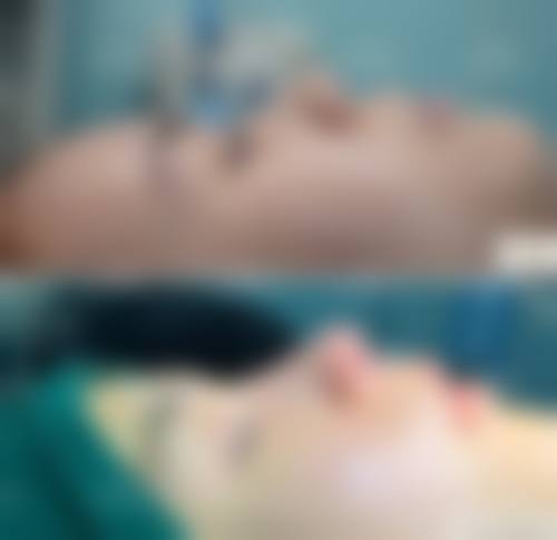朱海军 医生技术优势