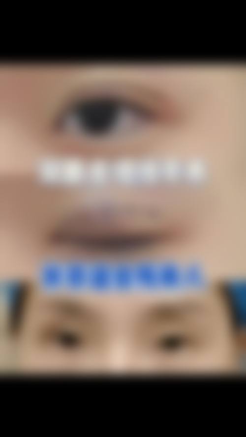 王立立医生项目收费价格