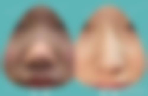 诊疗特色总结:魏仕红医生的个性化医美方案