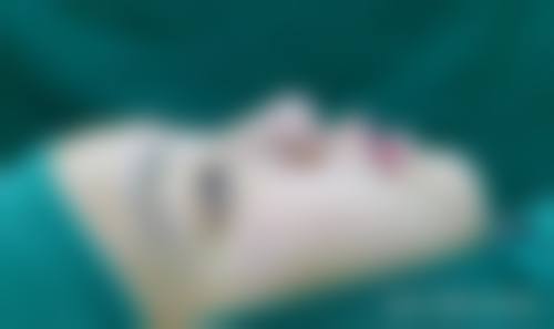 擅长项目详解:魏仕红医生玻尿酸除皱与抗衰抗初老项目