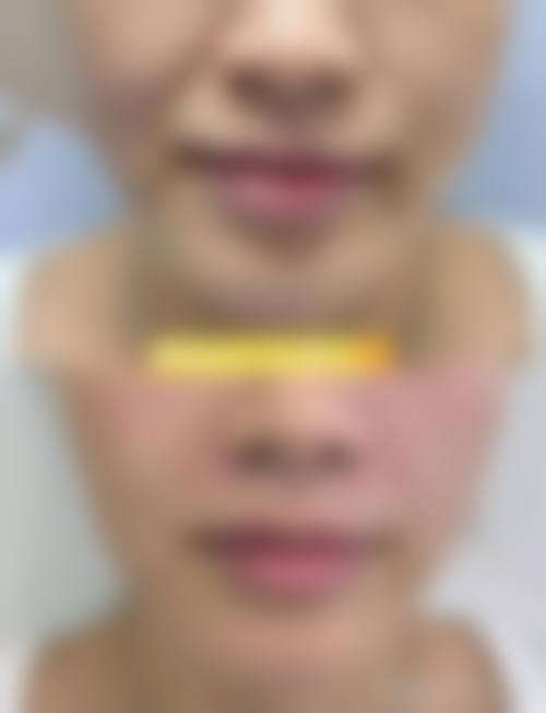 患者真实评价