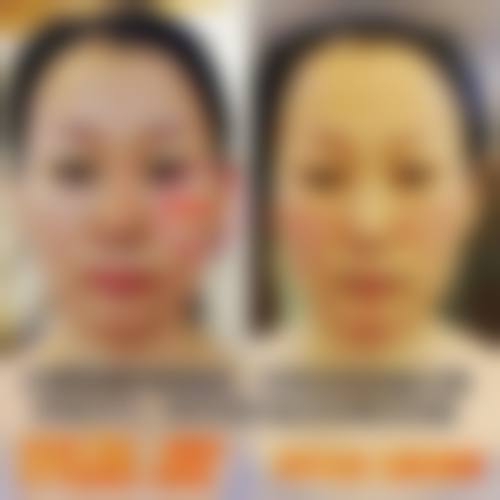 优惠活动详情