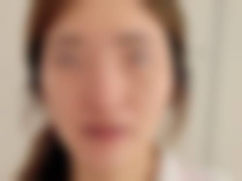 王立立医生技术优势